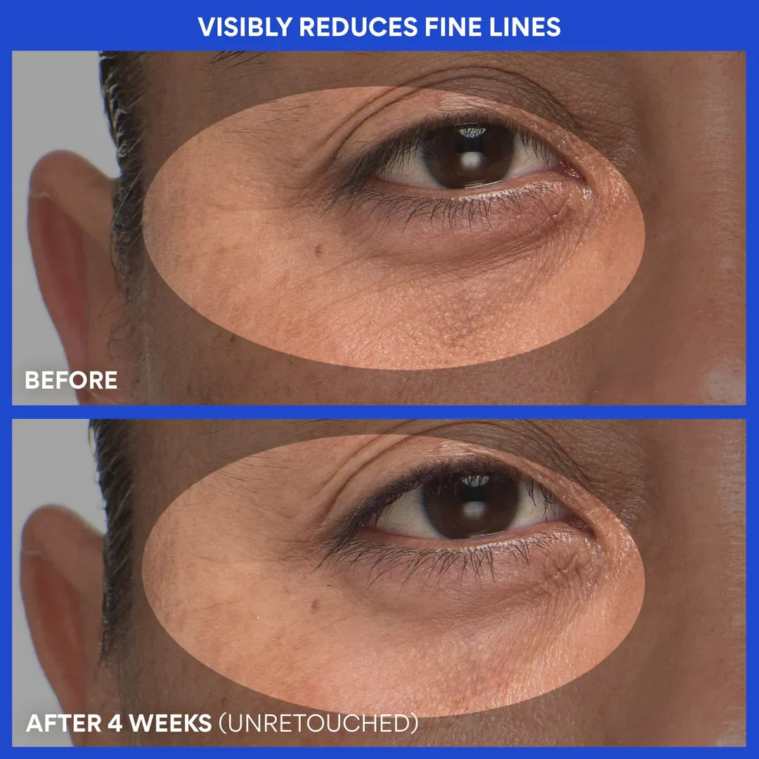 Eye Cream